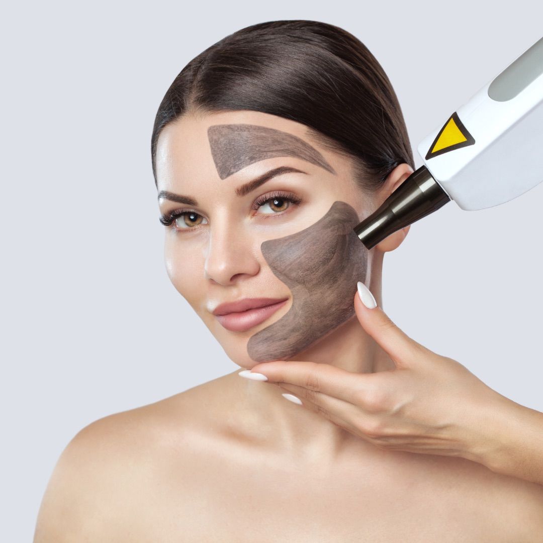 Carbon Laser Facial With Gua Sha at Tu Es Belle Spa Houston